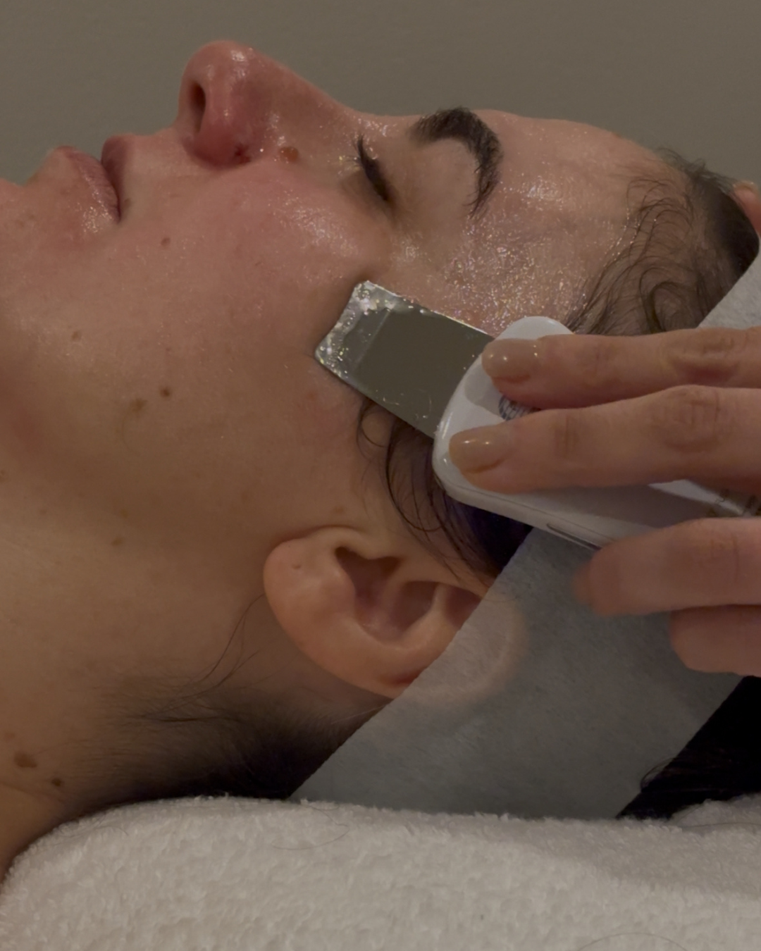 Personalised skin treatment at The Rejuvenation Space