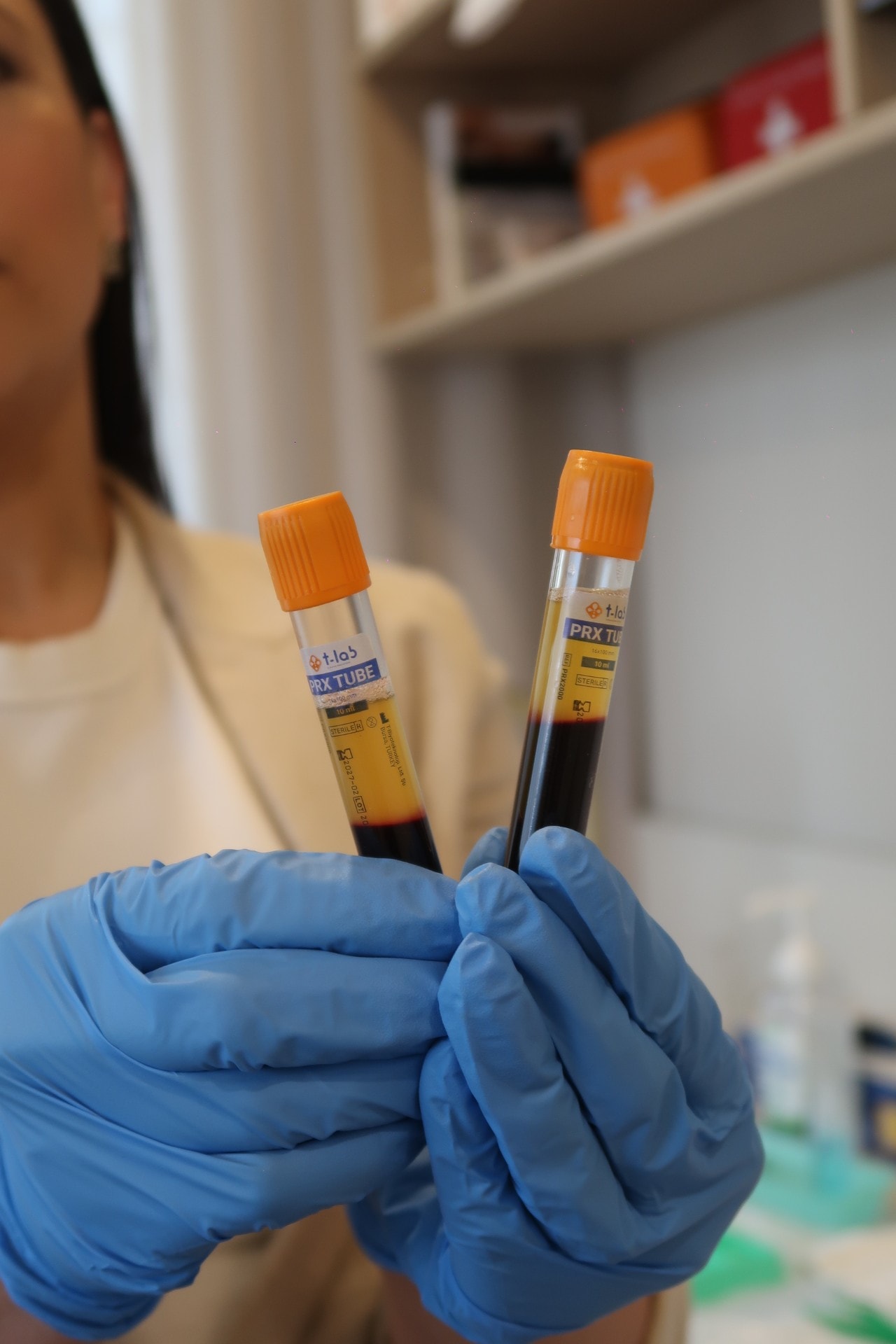 PRP blood sample preparation at The Rejuvenation Space